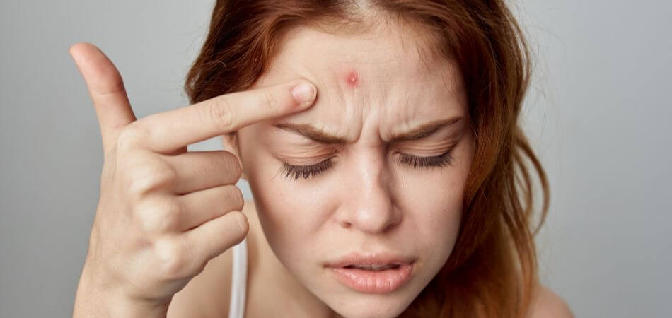 Can Coffee Cause Pimples